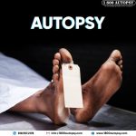 Autopsy
