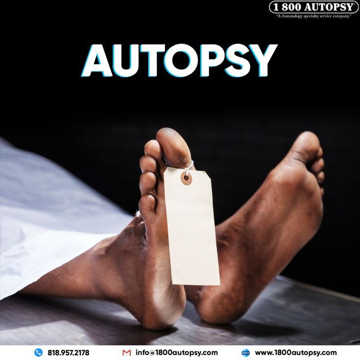 Autopsy