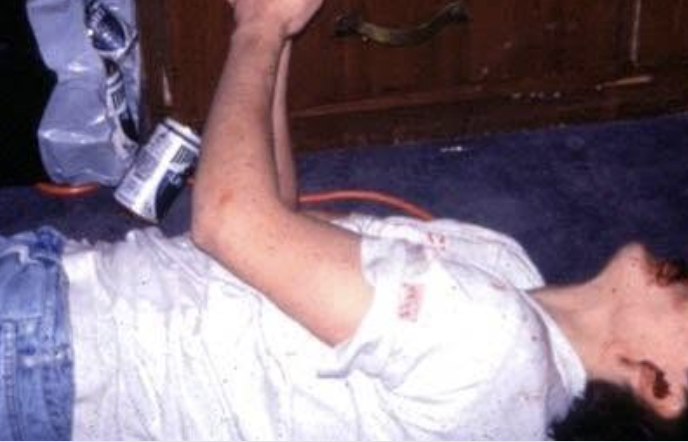 espasmo cadavérico 