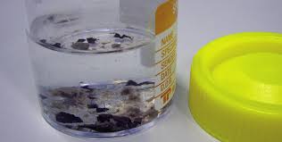 fijación del tejido