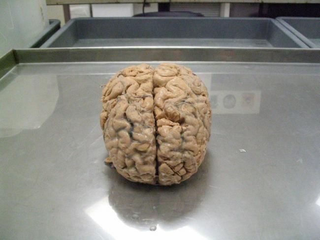 cerebro humano