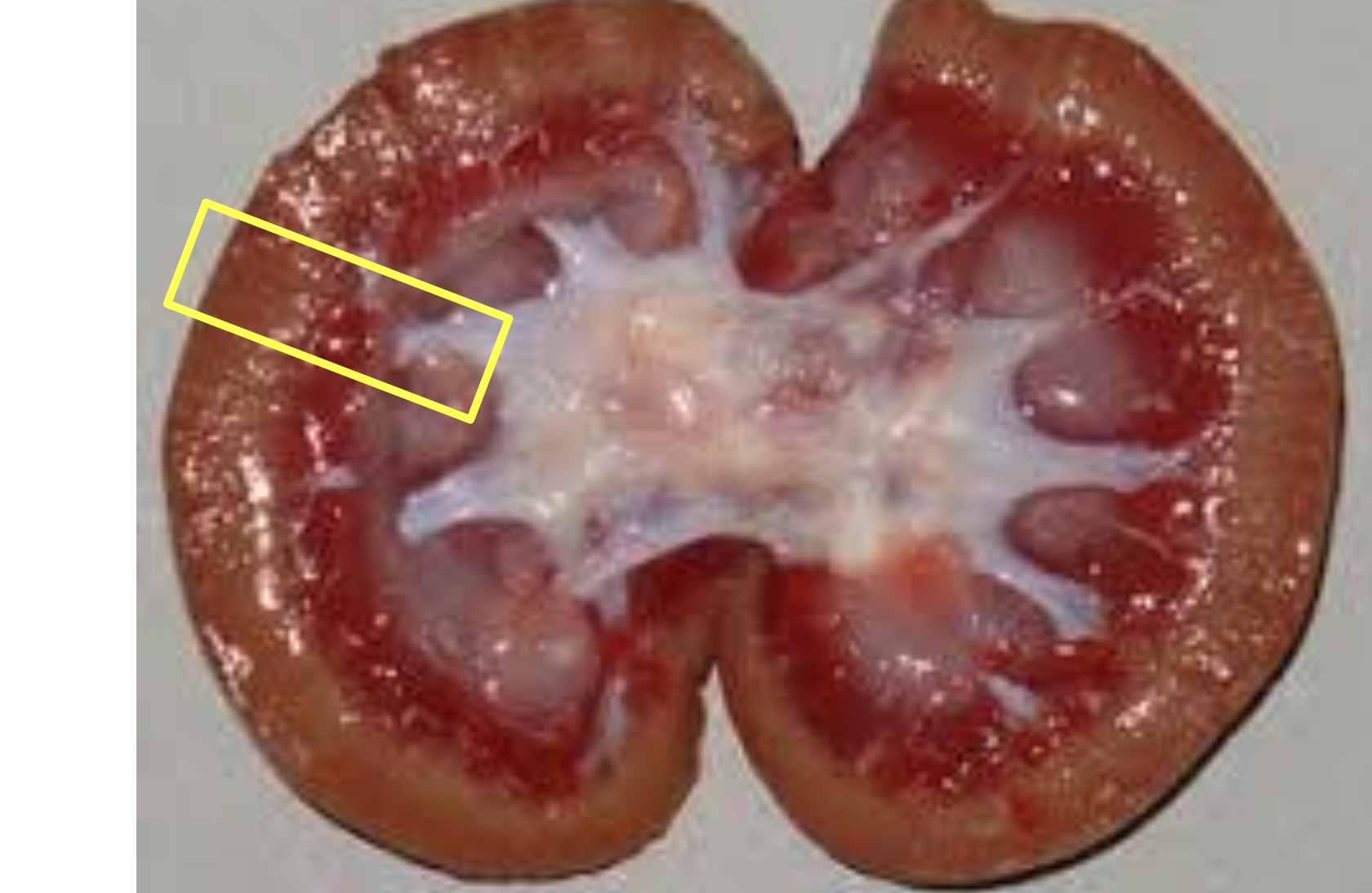 tallado y fijacion de muestras