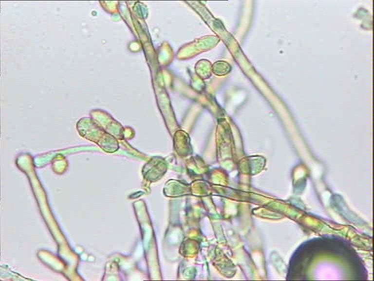Cladosporium_macrocarpum_070614Exd1