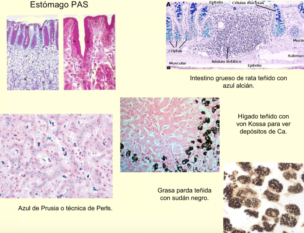 tinciones en anatomia patologica