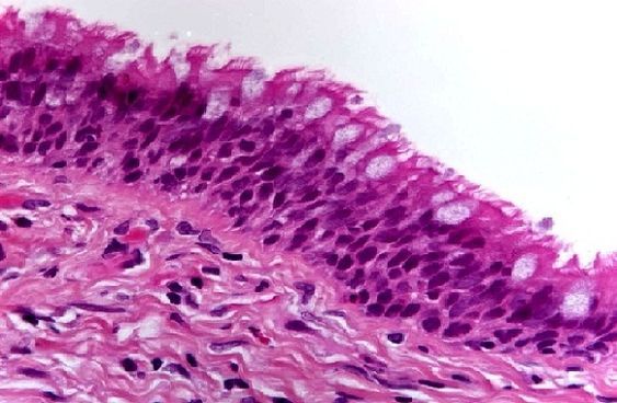 Hematoxilina-Eosina tinción