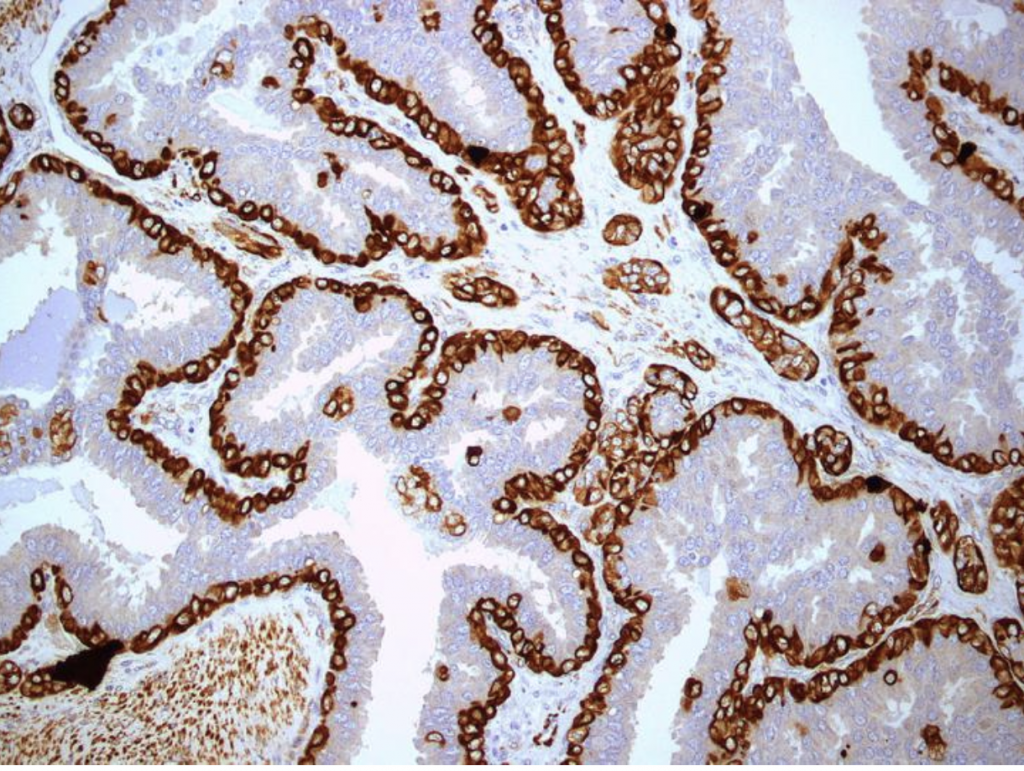 Tinciones Inmunohistoquímicas