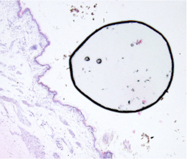 burbuja aire microscopio