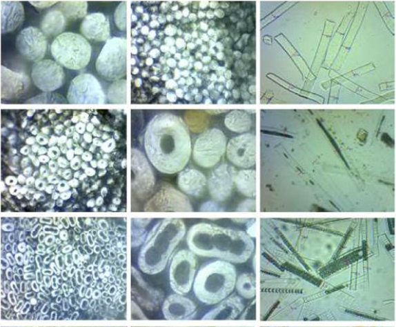 artefactos en microscopio
