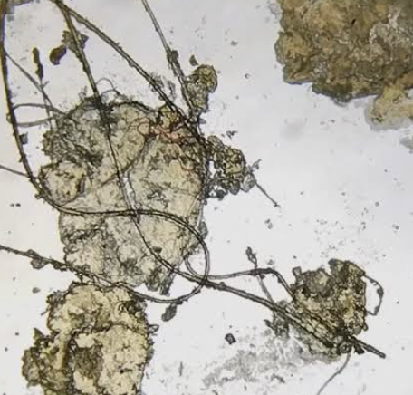 fibras microscopio
