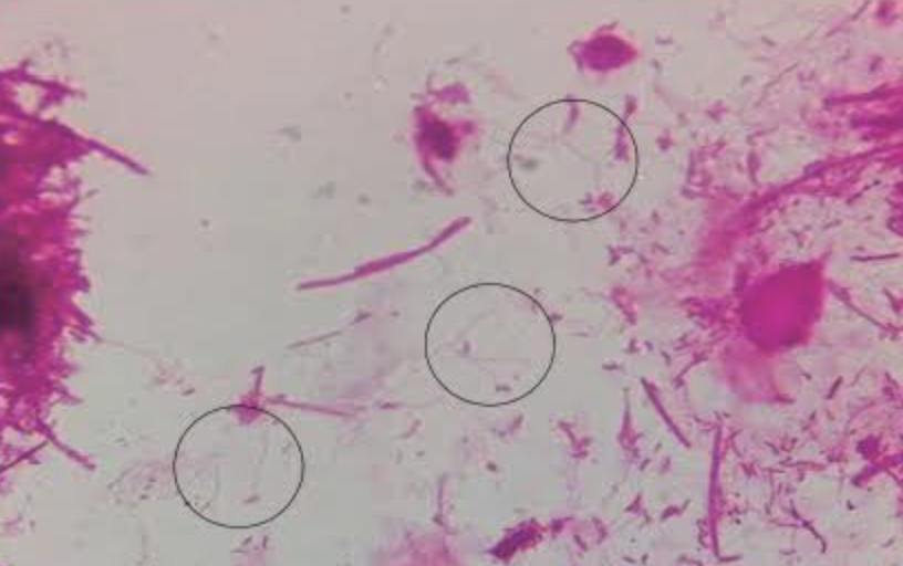 contaminacion microscopia