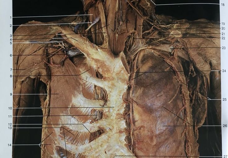 post mortem necropsia